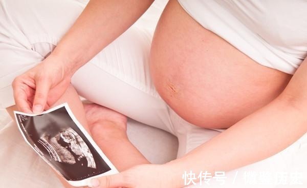 胎儿|孕期检查出胎儿“畸形”,是否应该生下来?专家:这些情况可以生