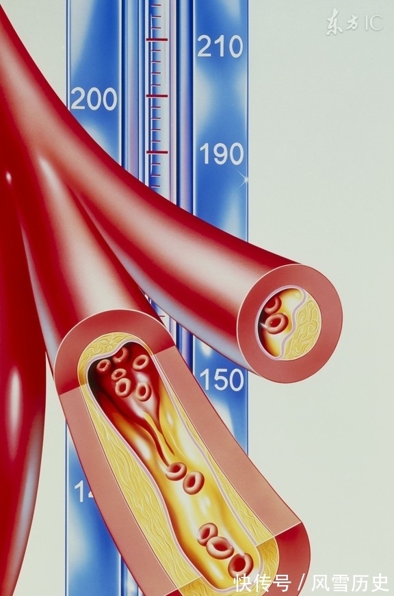 降血压|高血压能不能喝蜂蜜呢?今天告诉你,好多人被误导了