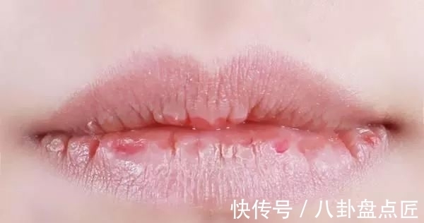 皮肤长痘、暗沉,还有大大的黑眼圈?年后紧急护肤大法教给你!