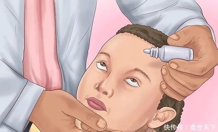 保护视力|孩子突然视力下降、视力模糊?有这8个习惯的人,最容易变近视!