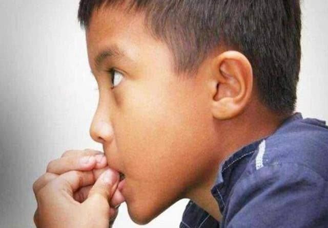 精神紧张|从小爱“咬指甲”不制止,长大后会怎样?3种结局或在等着你