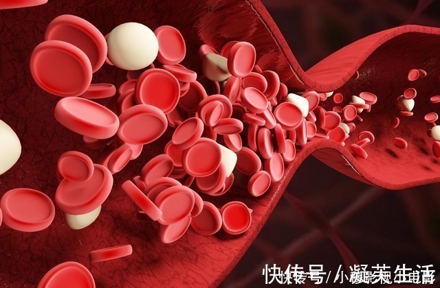 新标准|血糖新标准已出，到了这个年纪太高或太低都要注意，不妨了解一下