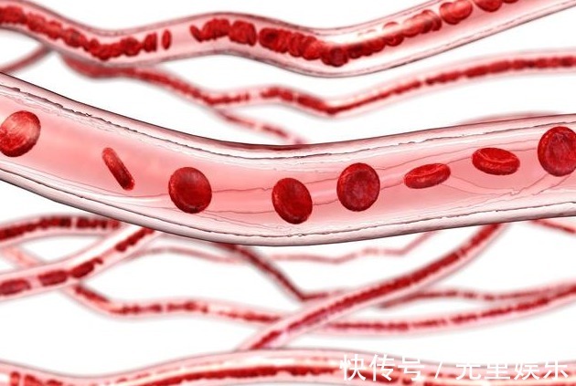 脑血栓|血栓最怕3个“动作”,若能坚持一个月,血管越来越干净