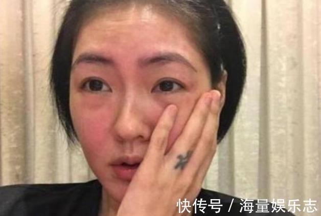 腹型肥胖|医生提醒血压高不高,看脸就知道,日常生活,坚持4招稳定血压