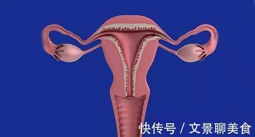 丝瓜|女性有子宫肌瘤?别怕,常吃这6种食物,肌瘤或将慢慢消失