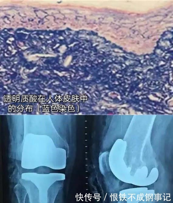 伊婉 玻尿酸的前生今世!护肤、口服、医美,竟然连TT里面都有添加!