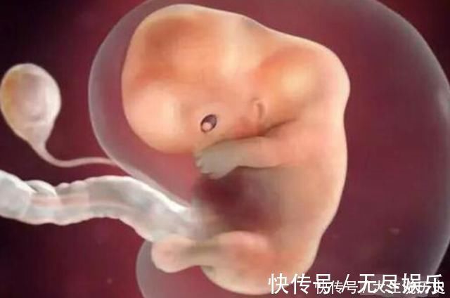 畸形|十月怀胎,哪几周是胎儿畸形的高发期看完后明白了
