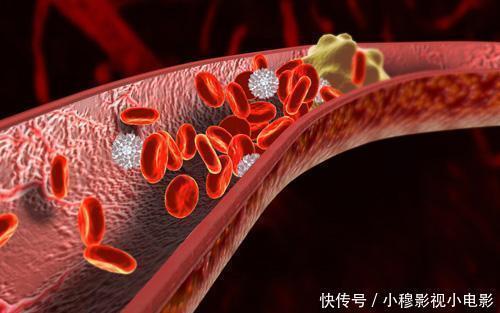 医生|多走路可以降血脂？心血管医生：过了50岁，做好3件事或更有效