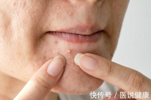 人体|肝不好体质变差、肤色暗黄!女性养肝,不妨尝试一下这4个方法