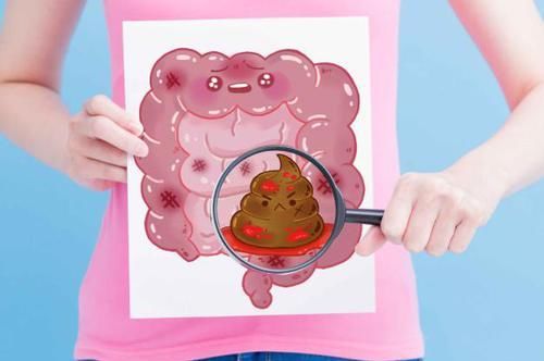  大便|癌症一查就是晚期？肿瘤医生：7大肿瘤信号，希望你全记牢！