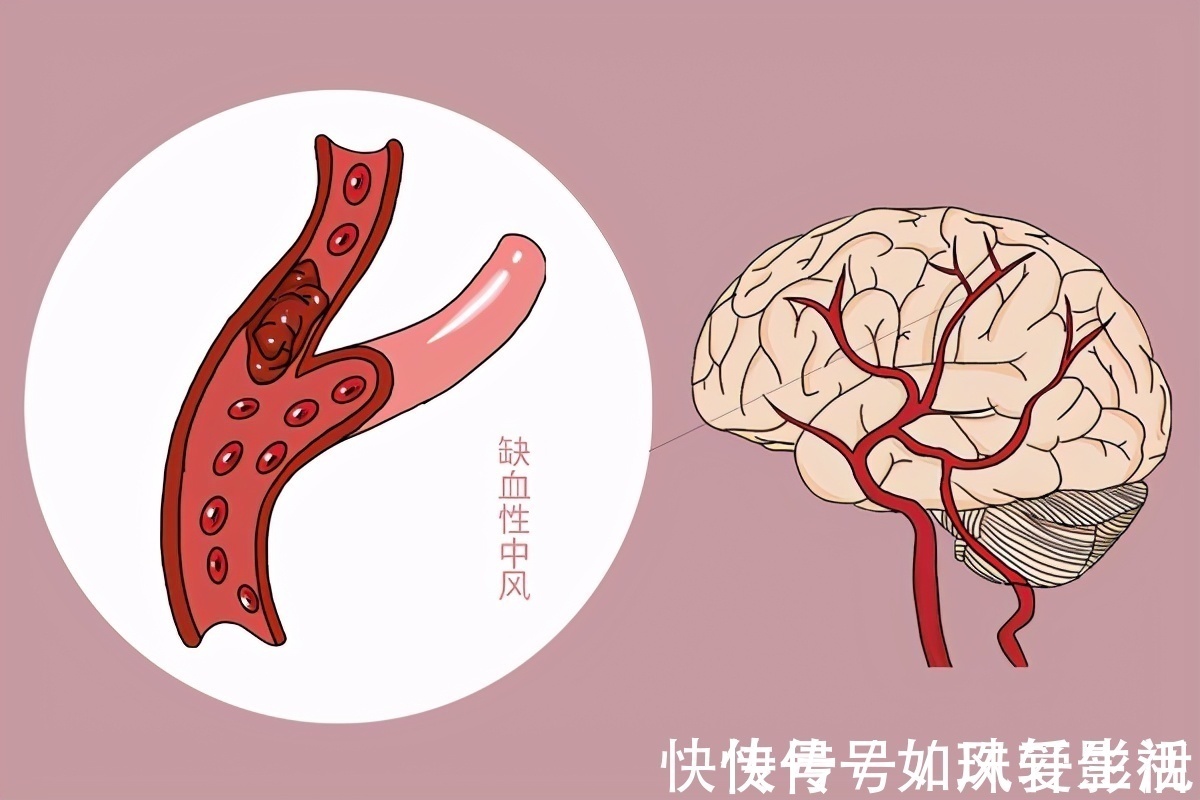 晚饭|每天晚饭时喝一二两白酒，能不能起到养生的作用？医生告诉您