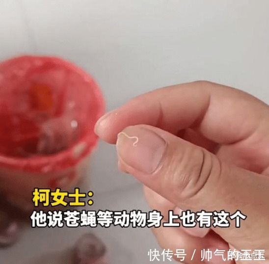 女童|2岁女童眼中取出3条白虫，妈妈误以为是眼屎，吓得不轻
