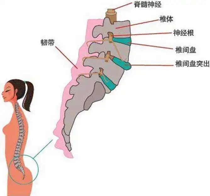 医生|冬天到，腰痛闹！松江医生教你如何防治