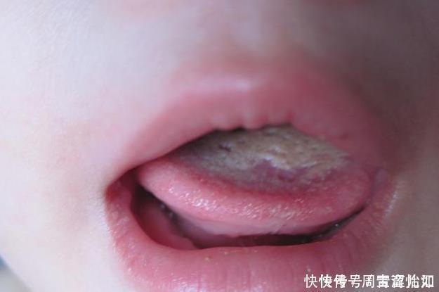 身高|孩子脾胃不好，不长个？谨记这“2事”，促进发育，身高棒棒的