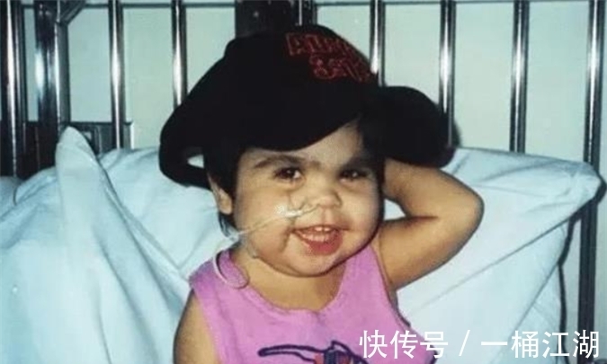 双腿|美国女孩出生患美人鱼症,喜欢在水里,生存十年创造医学奇迹