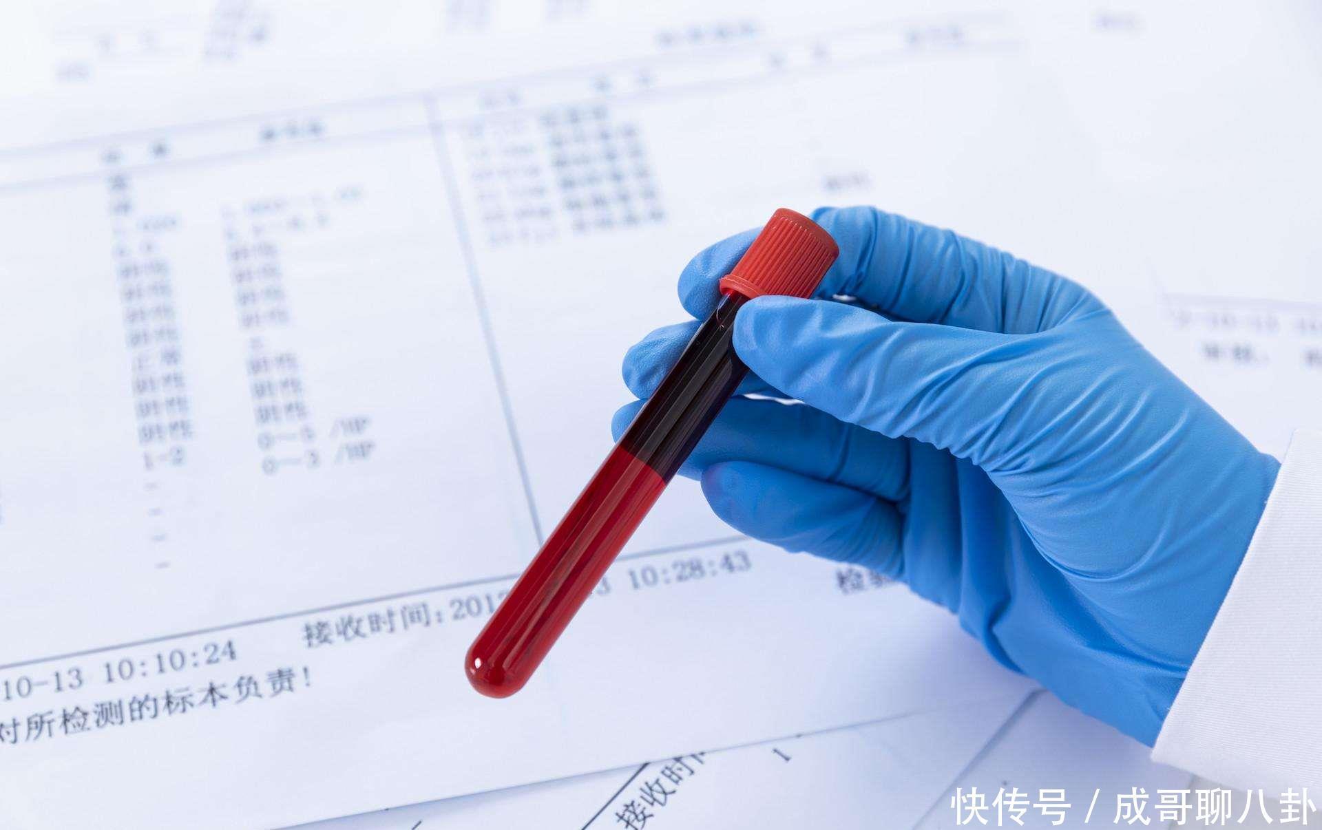 糖尿病检查报告如何看?血糖异常有哪些症状?每天测几次血糖才好