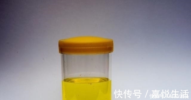 蒲公英|有糖尿病的人,若有这些表现,或许身体在慢慢好转,不妨自测!