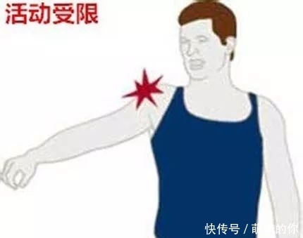 锻炼|拜拜,肩周炎!用一条毛巾来锻炼,不花钱效果还不错,试试吧!