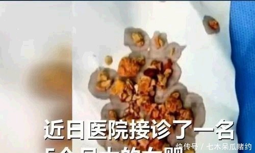 婴儿|5个月婴儿患“肾结石”，都是辅食惹的祸，医生很多家庭还在喂