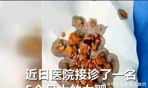 婴儿|5个月婴儿患“肾结石”,都是辅食惹的祸,医生很多家庭还在喂