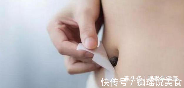 三伏贴|冬病夏治抓住一年中养阳的40天,阳虚的人记得提前安排好3件事