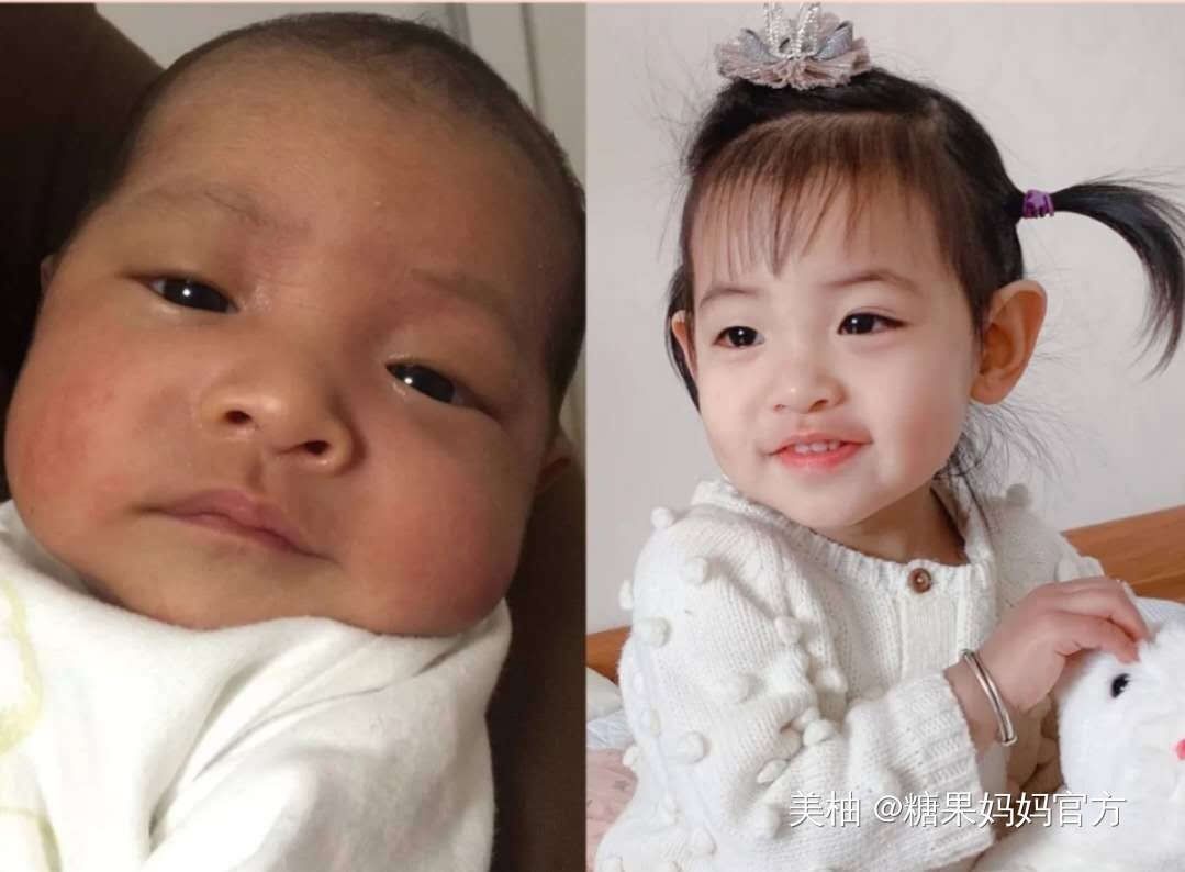 逆袭|新生儿这几个部位丑,反而预示高颜值,宝宝逆袭的我你高攀不起