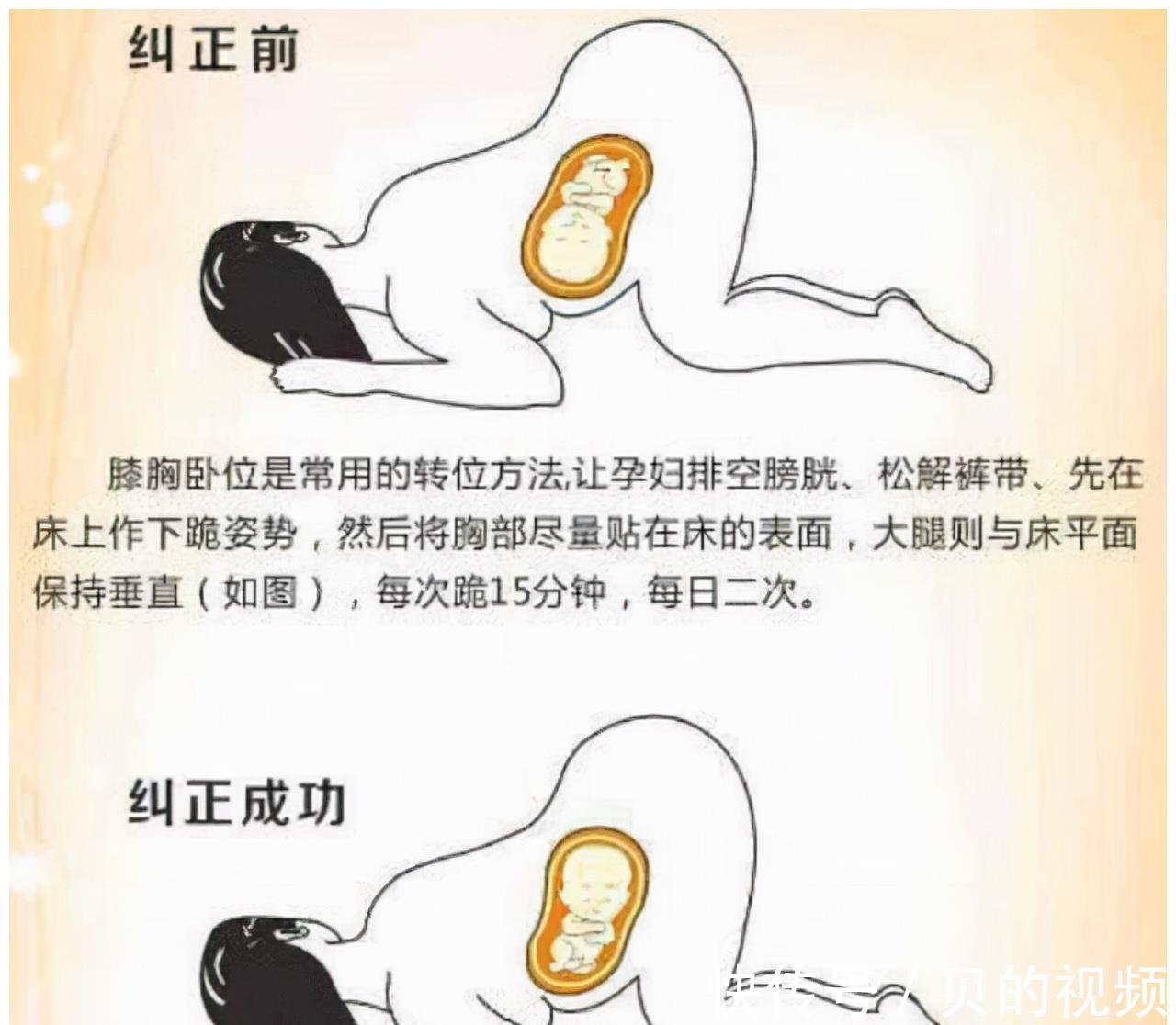 孕妇|到了这个孕周,胎儿“胎位”基本固定,以后再纠正就难了