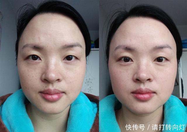 美白|颜值提升｜为什么皮肤变白了会更好看有效美白的成分是哪些