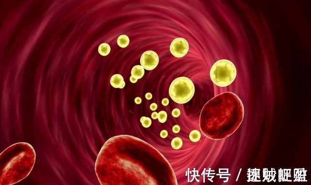 燕麦|吃一口的等于吃10斤猪油,不及时撤下做,小心脑梗找上你