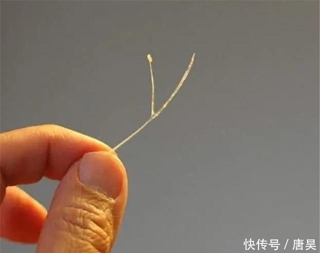 馒头|3岁儿子鱼刺卡喉咙,父母的两个举动,连医生都称赞很专业