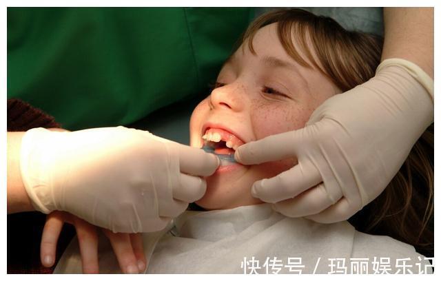 红心火龙果|积食可以吃火龙果?儿科医生:若想孩子脾胃好,建议常吃4种水果