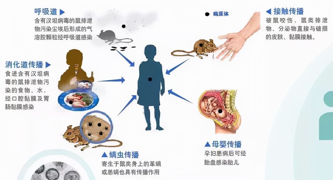 汉坦病毒|西安出现多例出血热，医生提醒：保护自己要做到这些