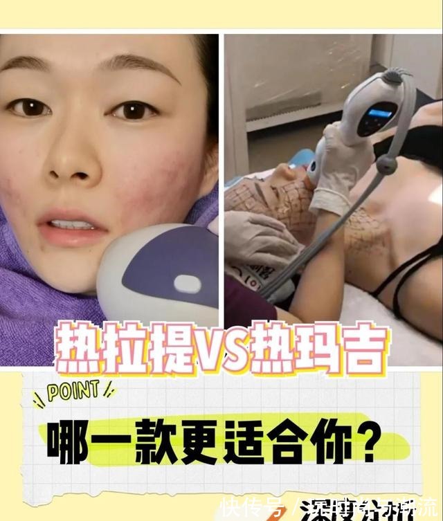 抗衰 热玛吉vs热拉提哪一款更适合你！