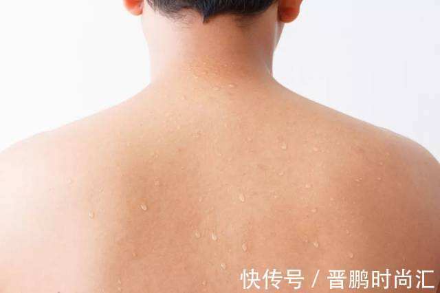黄芪|出汗里藏有大学问:12种出汗,位置不同,症状各异,你是哪种?