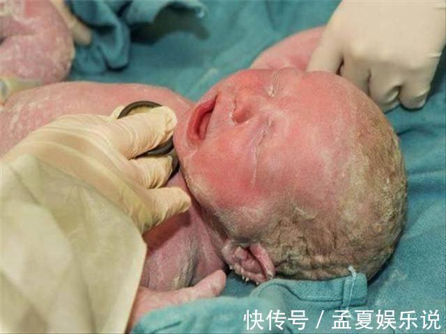 护士|婴儿刚出生后护士为什么要报几斤几两?医生不说,但是父母要知道