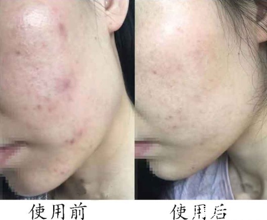 成分|北大医生警示:市售氨基酸洗面奶部分是伪氨基酸洗面奶,都是套路