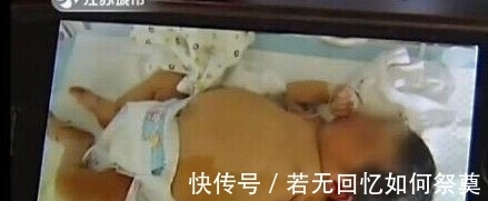 袁捷|【奇闻】孕妇产下“胎中胎”:刚出生8天女婴竟怀孕?