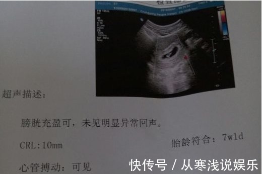 怀孕|怀孕期间,这5项检查能安全通过,说明宝宝健康聪明,准妈可放心