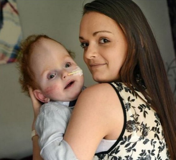 医生|男孩天生无大脑,医生断言很难存活,他的父母却让奇迹出现了