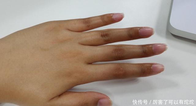 冰凉|血脂高的人，多留意手指，若没有这2个表现，脑梗或离你还很远