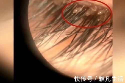 张女士|女儿总爱揉眼睛,妈妈感觉不对带去检查,医生的话让她后怕不已