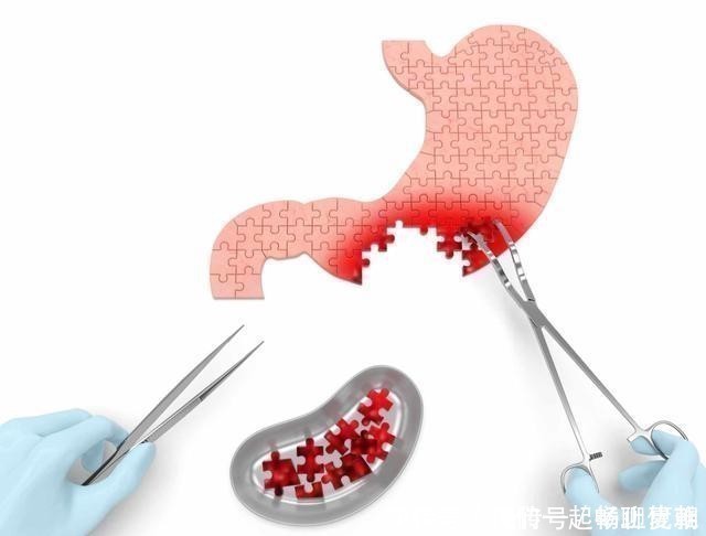 发生率|患上胃病的人,多数在睡前有这个“坏习惯”,有的话抓紧改
