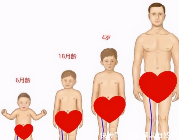 异常|大长腿“终结者”：O型腿、X型腿，怎样才能预防孩子腿型异常