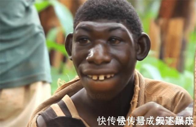 男子|非洲一男子长相似猴子,不吃饭只吃香蕉,常被人当动物欺负
