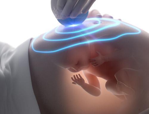 前置|产检检查出前置胎盘严重吗,该怎么治疗