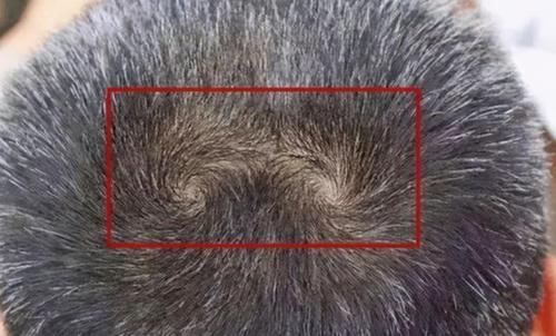 知晓|娃头上“一个旋”和“二个旋”有何区别?影响孩子性格,应知晓