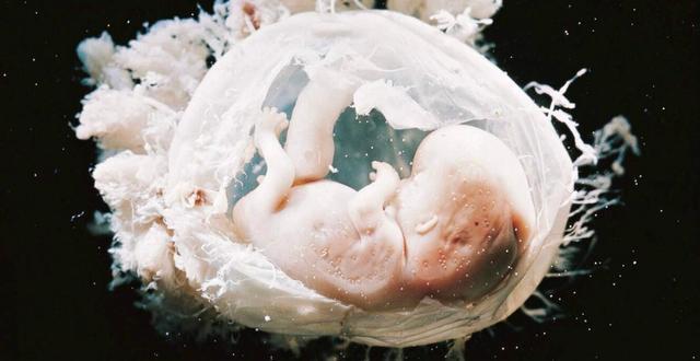 医生|现实版“哪吒”,产妇生下“带壳”宝宝想遗弃,医生却说恭喜你