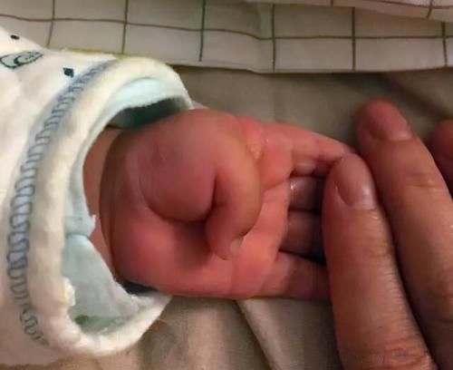 大脑|宝宝拇指内扣,大脑会很笨?超过这个月龄没好转,就该及时就医