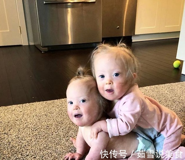 唐氏双胞胎|妈妈生下唐氏双胞胎姐妹,并不轻言放弃,唐宝都有一张相同的脸