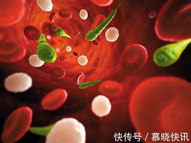 食物|50岁后有心血管疾病的人,4类食物要撤下餐桌,血管才能健康
